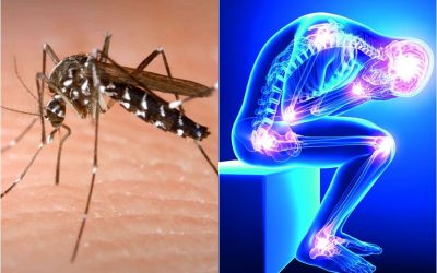 SAIBA MAIS SOBRE A CHIKUNGUNYA: SINTOMAS, TRANSMISSÃO E PREVENÇÃO