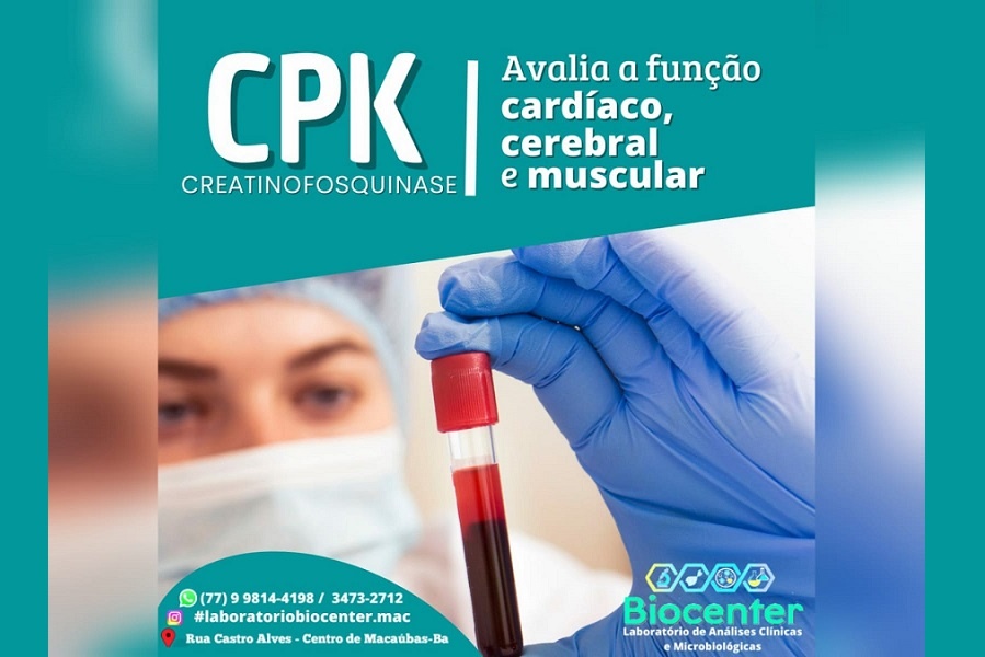 ATENÇÃO PARA O NOVO EXAME QUE VOCÊ PODE FAZER NO LABORATÓRIO BIOCENTER